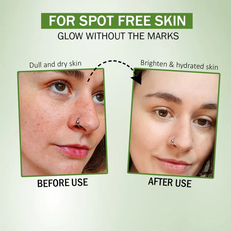 10% Naicinamide Face Serum